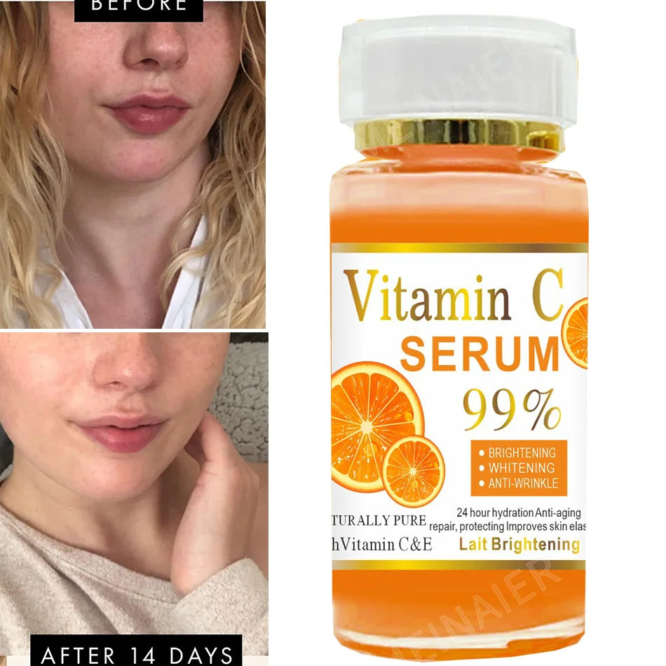 120ml 99% Vitamin C Serum Oil: Your Ultimate Facial Skin Brightening Solution