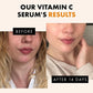 120ml 99% Vitamin C Serum Oil: Your Ultimate Facial Skin Brightening Solution