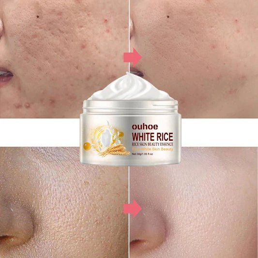 Rice Anti-Wrinkle Facial Cream for Acne, whitening and Pigmentation